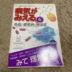 病気がみえる vol.6 (免疫・膠原病・感染症)