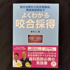 無歯顎補綴の臨床 Q&A - メルカリ