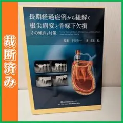 裁断済】咬合挙上 その意思決定と臨床手技 クインテッセンス出版