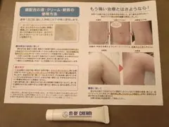 m-bf クリーム　m-bf cream 水いぼ