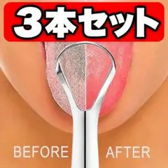 3本セット　口腔ケア✨ 舌クリーナー 舌リムーバー ステンレス製　口臭予防