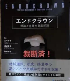 エンドクラウン : 理論と実践を徹底解説 = Endocrown : thor…