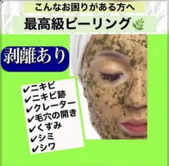 業務用 ハーブピーリング 剥離あり CICAハーブ 希少ハーブ アロエベラ