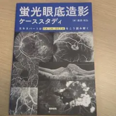 蛍光眼底造影ケーススタディ エキスパートはFA・IA・OCTAをこう読み解く Amazon.co.jp: 蛍光眼底造影ケーススタディ エキスパートはFA・IA