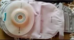 ストーマ装具　新品未使用　10枚　2箱 ストーマ装具 アーカイブ - 42ページ目 (70ページ中) - ストーマ