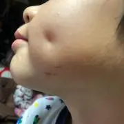 るいるい