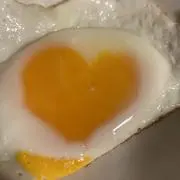 ANYUの画像