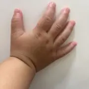 あこの画像