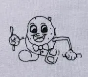 MRの画像