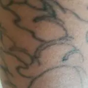 クマ