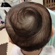 カイママ