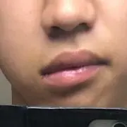 (°_°)