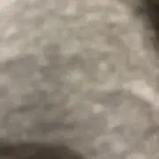 匿名希望の画像