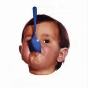 生ハムベーコンの画像