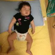 RDの画像