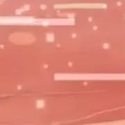Poco