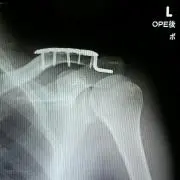 ぃでちぇびっち