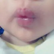 chokochoko