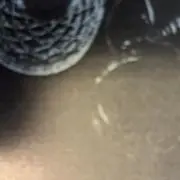 や