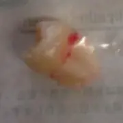 山口