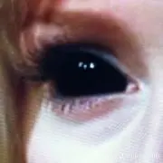 osの画像