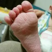 ハルパパ