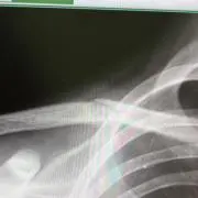 カリフラワーの画像
