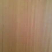 tkcgm
