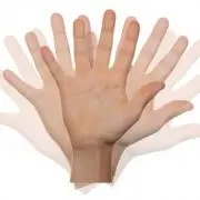 044