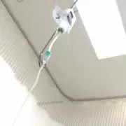チョッパー