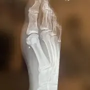 マイルドセブン