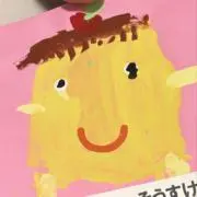しみ