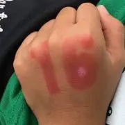 Mi Igの画像