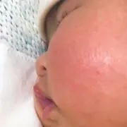 Lilyの画像