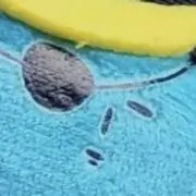 ゴールデンたんこぶ
