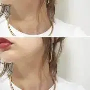 choco