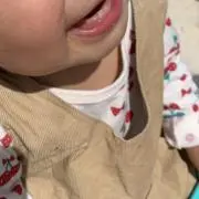 はげ子の画像