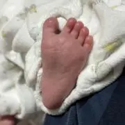 ポークピッツの画像