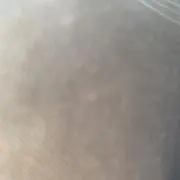 Ri