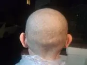プクプクの画像