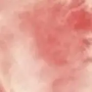 ももの画像