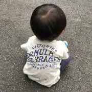 R@@S