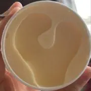 えくぼの画像