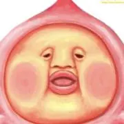ももじりの画像