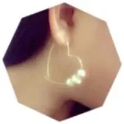 rara