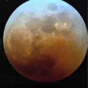 もちもちん