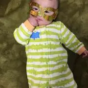 AO
