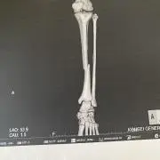 嵐