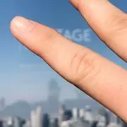 木耳