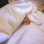 AKIの画像